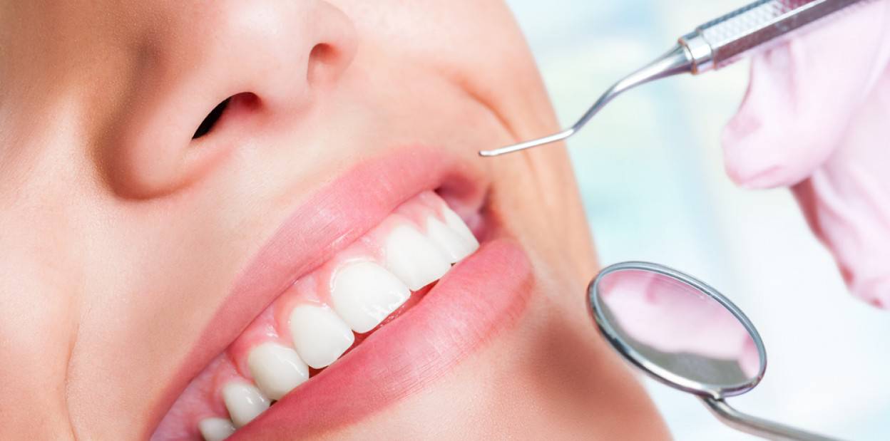 Як роблять реставрацію зубів?