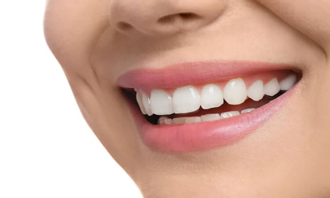 Як підготуватися до плазмоліфтингу ясен