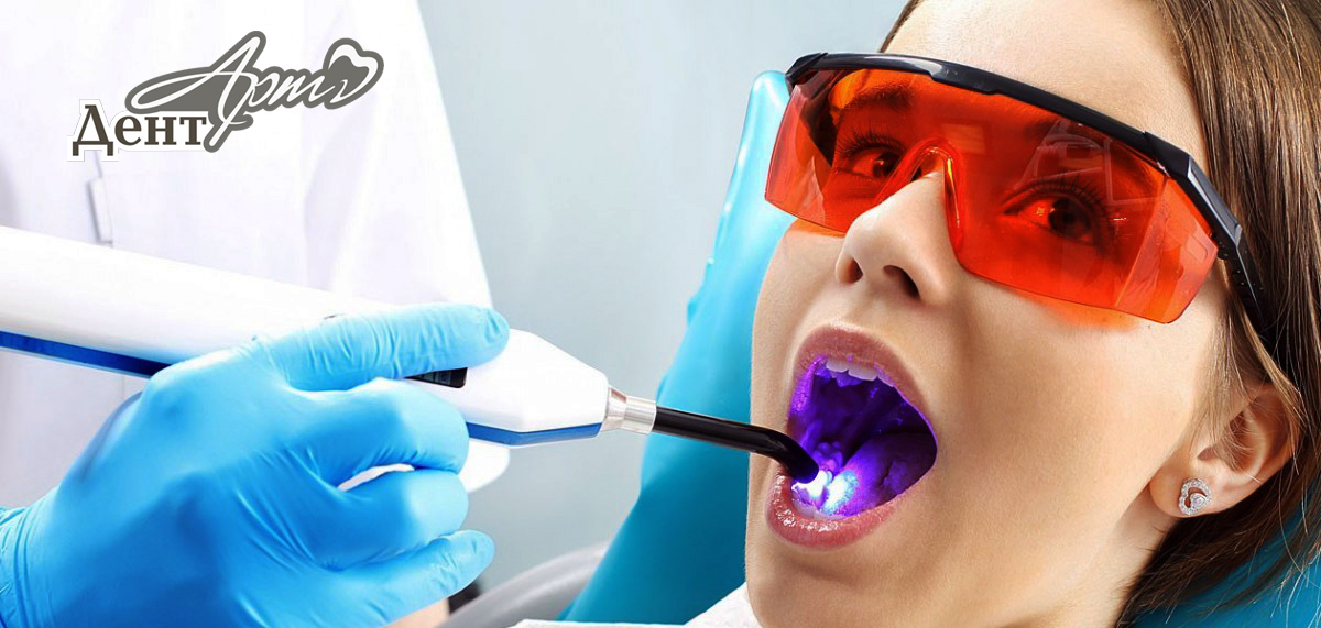 Что такое лазерная терапия в стоматологии?