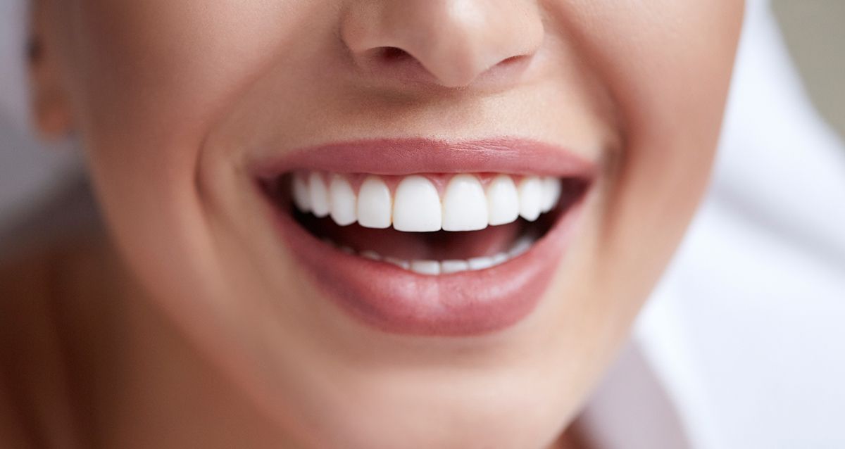 Чем профессиональные методы отбеливания зубов лучше домашних средств?