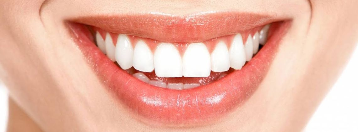 Виды виниров и эффективность их применения