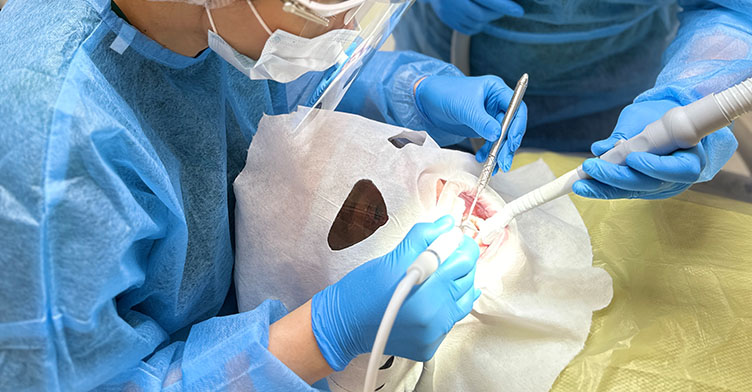 Пломбування кореневих каналів